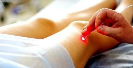 inflamație inflamație