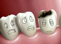 dent