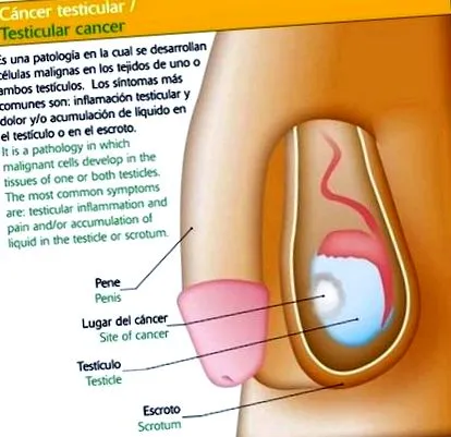viroterápia fiatal férfiak
