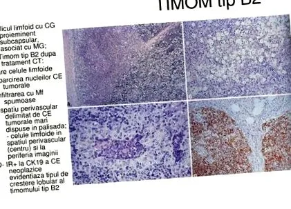 thymus