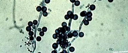 organic candida