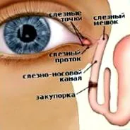 дакриоцистит
