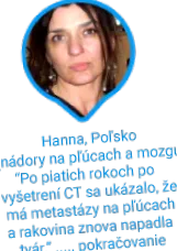 tumori simptomelor