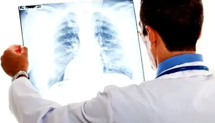 pneumonie incubație