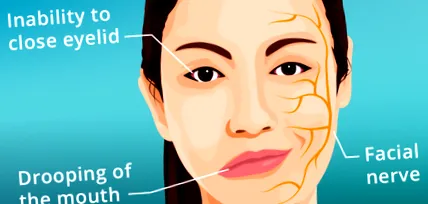 facial facial