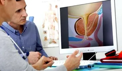 prevenirea cancerului