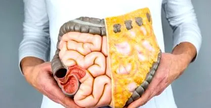 colon colon