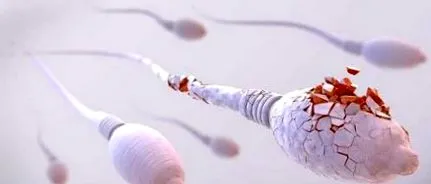 spermiogram