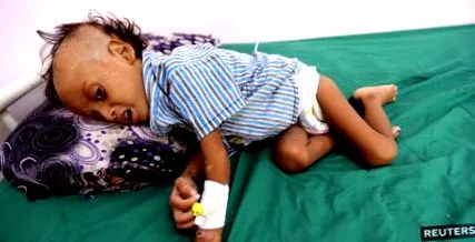 murit yemen
