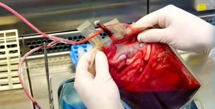vara