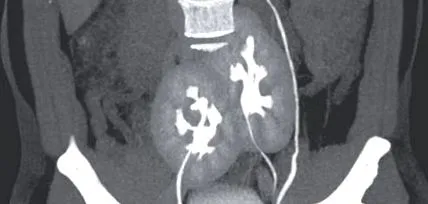 unic bărbații