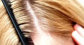 hormonális rendellenességek