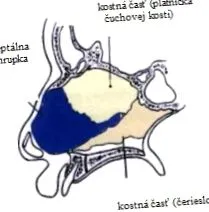 devierea devierea