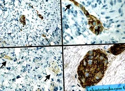 imunohistochimiei periferice