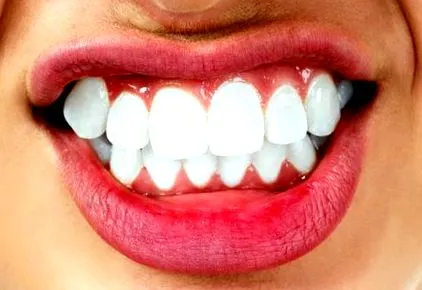 sanatate dentara