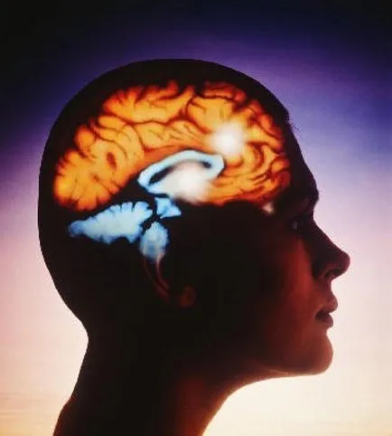 Mi a stroke, és miért történik