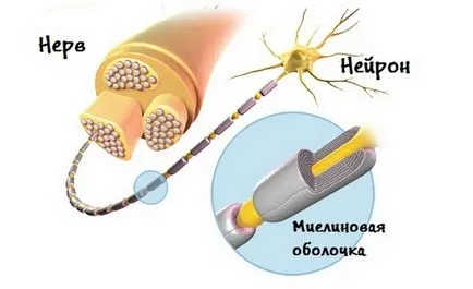 Megbetegedésének az agy, hogy ez, mielin gócok az agyban
