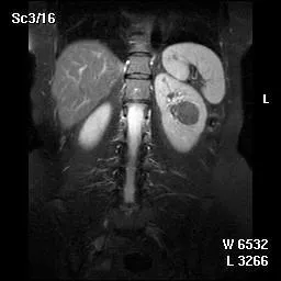invazív echoscopy