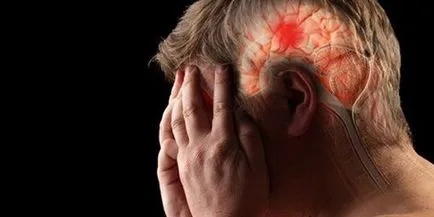 Stroke és annak következményei - mik a túlélés esélyeit