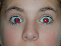 Mert, hogy mi történik, és hogyan kell eltávolítani a vörös szemeket a képen (eltávolítás) Mert, hogy mi történik, és hogyan kell eltávolítani a vörös szemeket a fotó