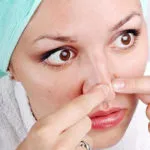 Hogyan és mit hoz a sötét foltok az arcon (pigment) Hogyan és mit hoz a sötét foltok az arcon