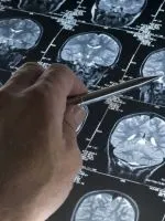 Hogyan lehet növelni a szintű intelligencia (IQ) Hogyan lehet növelni a szintű intelligencia