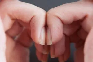 Hogyan készítsünk egy szép alakú a köröm otthon (köröm) Hogyan készítsünk egy szép formájú körmök otthon