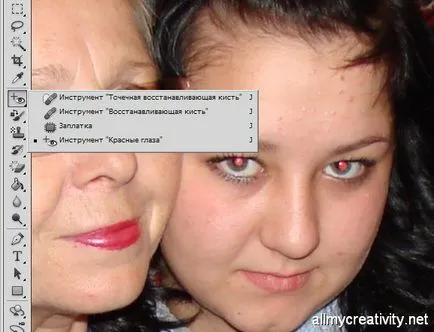 Hogyan lehet eltávolítani a vörös szemet a fotó (piros-szem) Hogyan lehet eltávolítani vörös szemet fotók
