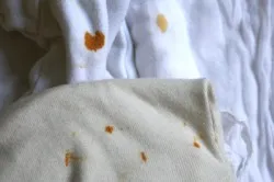 Hogyan lehet eltávolítani a rozsdát ruházat (rozsda a ruházat) Hogyan lehet eltávolítani a rozsdát ruházat