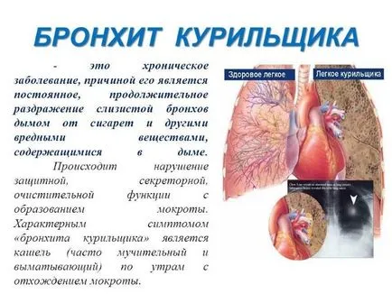 Dohányos köhögés, hogyan lehet megszabadulni a tünetek (köhögés) Dohányos köhögés, hogyan lehet megszabadulni a tünetek