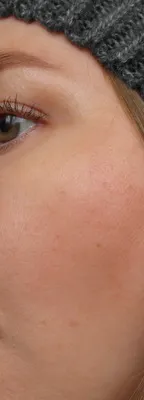 Kompakt rouge Clarinsés pirulni Prodige (árnyalat száma 05 rose wood) - vélemények, fényképek és ár (compact) Kompakt rouge Clarinsés pirulni Prodige (árnyalat száma 05 rose wood) - vélemények, fényképek és ár