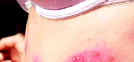 zsindelyes