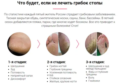A leghatékonyabb nemzeti eljárások kezelésére köröm gomba