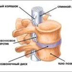 Bordaközi neuralgia tünetek és a kezelés otthon (home) Bordaközi neuralgia tünetek és a kezelés otthon