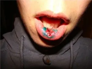 A belső alsó ajak megjelent bump okok (ajak) A belsejében az alsó ajak megjelent okoz egy dudor