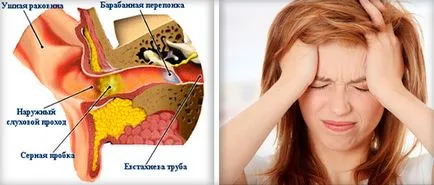 Sensation víz a fülébe, hogy nem, hogyan kell levezetni a vízcseppek speciális rasstvoreniya fülzsír (kezelés) Sensation víz a fülébe, hogy mit kell tenni, hogyan lehet eljutni a víz, speciális cseppek rasstvoreniya fülzsír