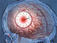 Abból, amit a stroke és miért történik