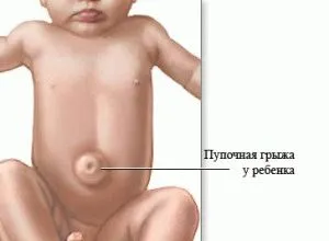 Ahol a gyerekek másznak születéskor fotó, baba születése