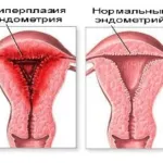 Miért nem IVF után terhes lett (videó)