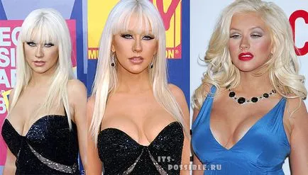 Plasztikai sebészet Christina Aguilera