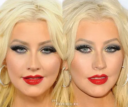 Plasztikai sebészet Christina Aguilera