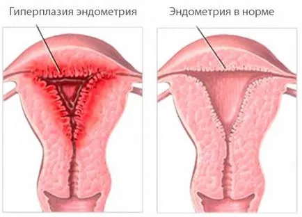 Miután az abortuszra, nincs pont -, hogy mikor kezdődik, miután a terhesség-megszakítás (terhesség) Miután az abortuszra, nincs pont -, hogy mikor kezdődik, miután az abortusz