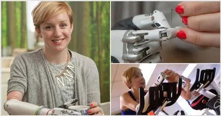 Az ortopéd kezét - a felülvizsgálat livemd (kéz) Az ortopéd kezek - felülvizsgálat livemd