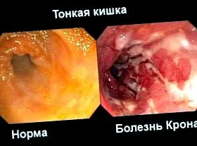 elkülönítése elkülönítése
