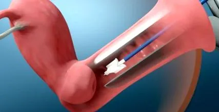 leci