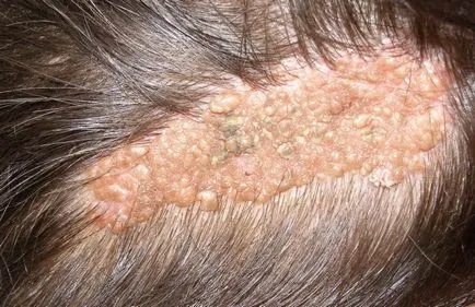 Anyajegyek az újszülöttek fotó okoz féle pigment foltok (foltok) Anyajegyek vannak képek újszülöttek féle okok öregségi foltok