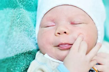 Birthmarks az újszülöttek okoz, típusú és módszerek harc (faj) Anyajegyek az újszülöttek okoz, és módok harc