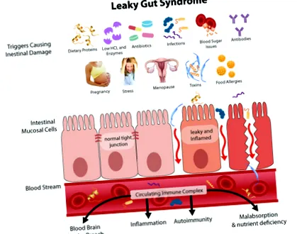 intestinálnu