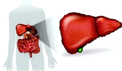 hepatitis