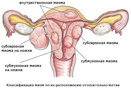 A szerkezet a méh